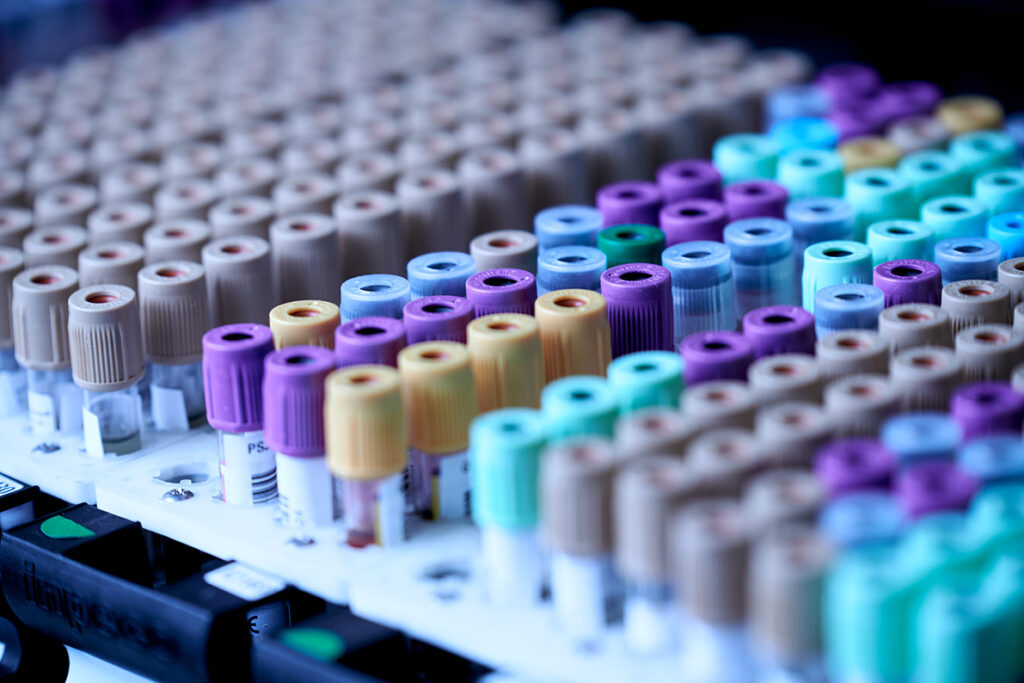 laboratori analisi cliniche a rischio chiusura